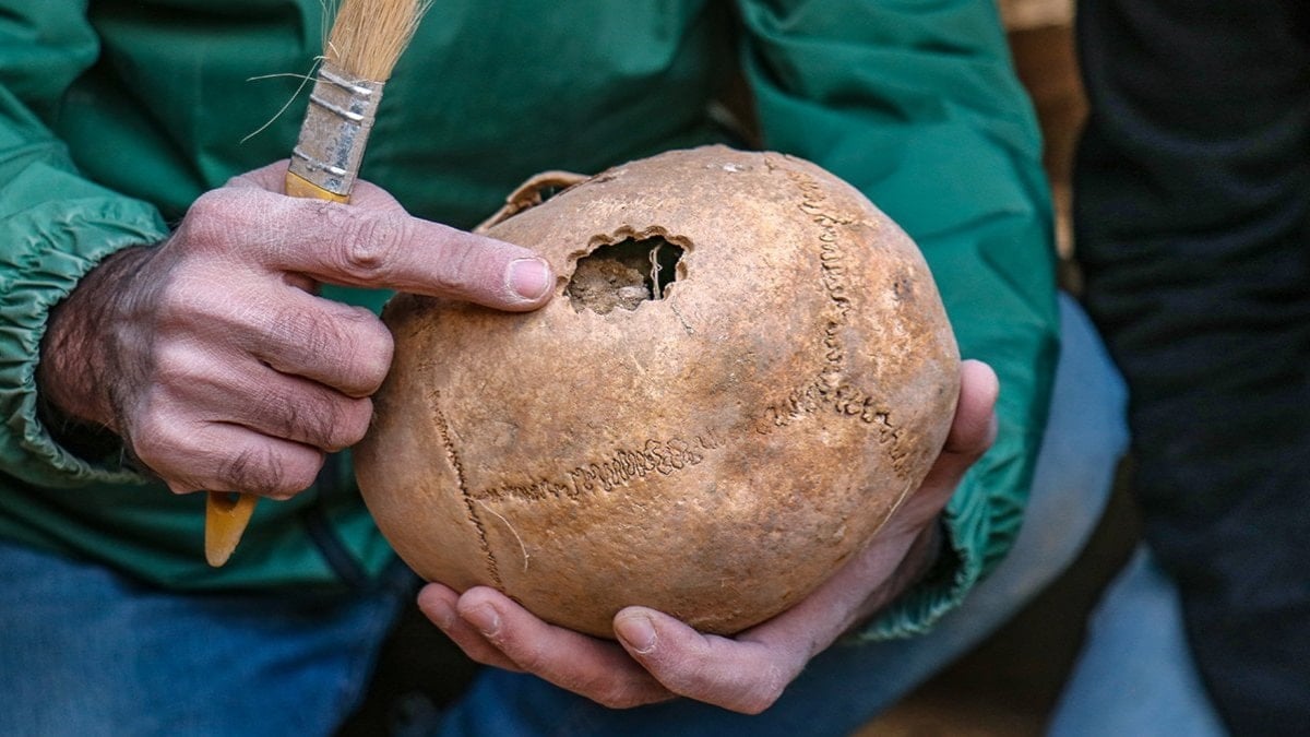Van’da 3 bin 200 yıl öncesine ilişkin beyin ameliyatı izine rastlandı